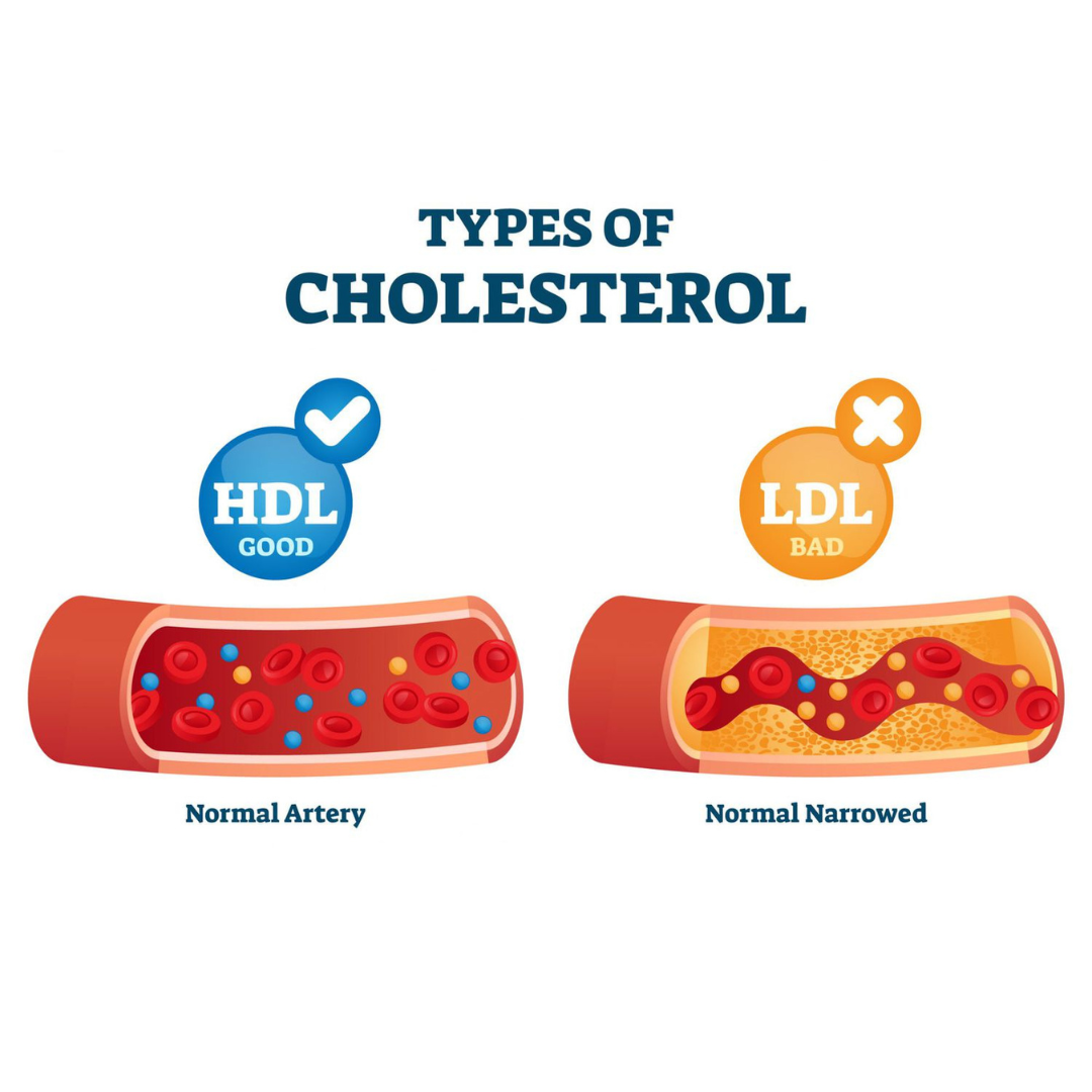 Sam My giup giam cholesterol xau, ngan ngua benh tim mach